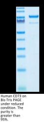 Human CD73/NT5E Protein (CD7-HM273)