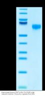 Biotinylated Human CD47 Protein (CD7-HM547B)