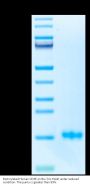 Biotinylated Human CD3E/CD3 epsilon Protein (Primary Amine Labeling) (CDE-HM101B)