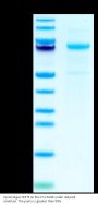 Cynomolgus CDH3/Cadherin 3 Protein (CDH-CM103)