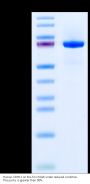 Human CDH11/Cadherin 11 Protein (CDH-HM111)