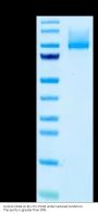 Human CDH6/Cadherin 6 Protein (CDH-HM116)