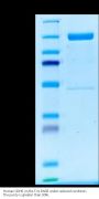 Human CDH6/Cadherin 6 Protein (CDH-HM206)
