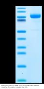 Biotinylated Human CDH6/Cadherin 6 Protein (CDH-HM406B)
