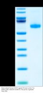 Biotinylated Human CD27 Ligand/CD70 Trimer Protein (Primary Amine Labeling) (CDL-HM427B)