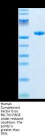Human Complement Factor D/CFD Protein (CFD-HM201)