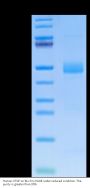 Human CTGF/CCN2 Protein (CGF-HM101)