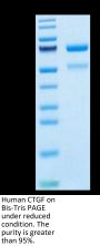 Human CTGF/CCN2 Protein (CGF-HM201)
