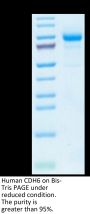 Human CDH6/Cadherin 6 Protein (CHD-HM106)