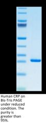 Human C-Reactive Protein /CRP Protein (CRP-HM101)