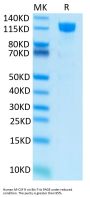 Human M-CSF R/CSF1R/CD115 Protein (CSF-HM21R)