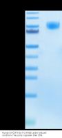 Human M-CSF R/CSF1R/CD115 Protein (CSF-HM41R)