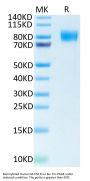 Biotinylated Human M-CSF R/CSF1R/CD115 Protein (CSF-HM41RB)