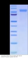 Cynomolgus CSPG4/MCSP Protein (CSP-CM1P4)