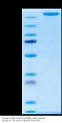 Human CSPG4/MCSP Protein (CSP-HM1P4)