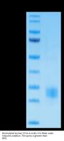 Biotinylated Human CTLA-4/CD152 Protein (CTL-HM401B)