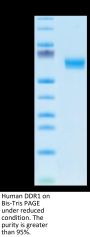 Human DDR1 Protein (DDR-HM1R1)
