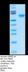 Human DDR2 Protein (DDR-HM1R2)