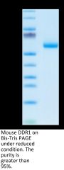 Mouse DDR1 Protein (DDR-MM1R1)