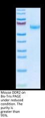 Mouse DDR2 Protein (DDR-MM1R2)