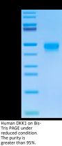 Human DKK1 Protein (DKK-HM101)