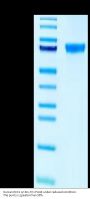 Human DKK1 Protein (DKK-HM201)