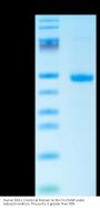 Human DKK1 C terminal Domain Protein (DKK-HM31C)