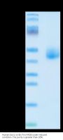 Human DLK1 Protein (DLK-HM101)
