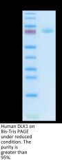 Human DLK1 Protein (DLK-HM201)
