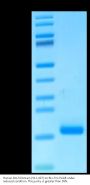 Human DLL3 Domain (311-427) Protein, Ultra Low Endotoxin (DLL-HM1D3-UL)