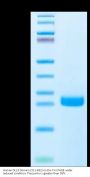 Human DLL3 Domain (311-492) Protein (DLL-HM1D4)