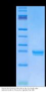 Human DLL3 Domain (352-479) Protein (DLL-HM4D2)