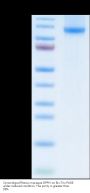 Cynomolgus/Rhesus macaque DPPIV/CD26 Protein (DPV-CM126)