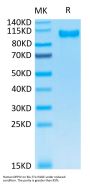 Human DPPIV/CD26 Protein (DPV-HM126)