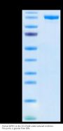 Human DPPIV/CD26 Protein (DPV-HM226)