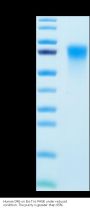 Human DR6/TNFRSF21 Protein (DR6-HM101)