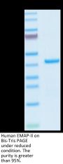 Human EMAP-II/AIMP1 Protein (EAP-HE102)