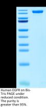 Human EGFR/HER1 Protein (EGF-HM201)