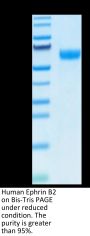 Human Ephrin-B2/EFNB2 Protein (ENB-HM201)