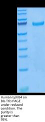 Human EphB4 Protein (EPB-HM104)