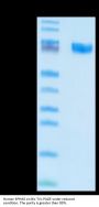 Human EPHA5 Protein (EPH-HM1A5)