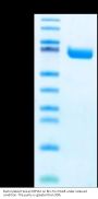 Biotinylated Human EPHA2 Protein (EPH-HM4A2B)
