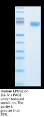 Mouse EPHB2 Protein (EPH-MM101)