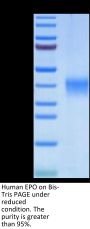 Human EPO/Erythropoietin Protein (EPO-HM001)