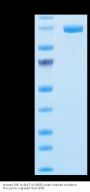 Human FAP Protein (FAP-HM201)