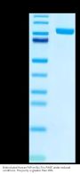 Biotinylated Human FAP Protein (FAP-HM401B)