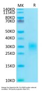 Human Fas Ligand/TNFSF6 Protein (FAS-HM10L)