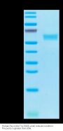 Human Fas/TNFRSF6/CD95 Protein (FAS-HM201)