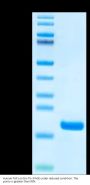 Human FGF1 Protein (FGF-HE00A)