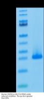 Human FGF10 Protein (FGF-HE010)